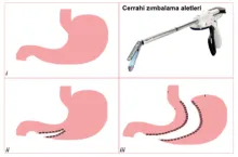 The Continuous Surgical Stapler developed by Sabancı University won first prize in the 8th Surgical Research Congress held by the Turkish Surgical Society